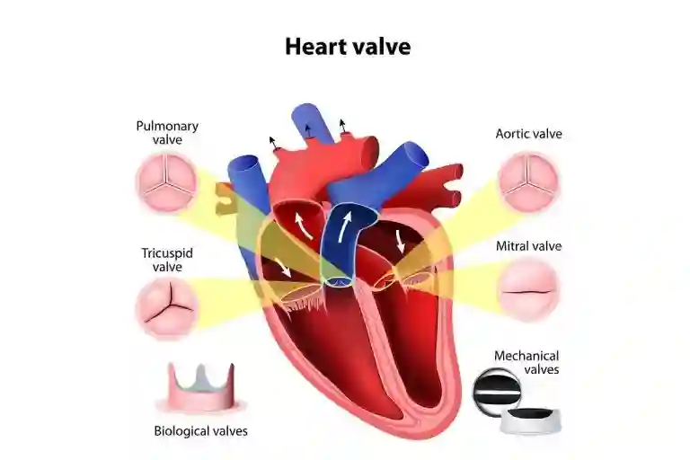 Medical illustration of heart valves (pulmonary, tricuspid, aortic, mitral) and valve replacements used at Cardiac Care Associates, best cardiac care centre in Bhopal.