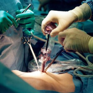 Doctors performing minimally invasive laparoscopic surgery using advanced instruments at Cardiac Care Associates, best cardiac care centre in Bhopal.