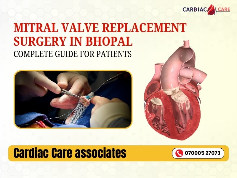 Mitral Valve Replacement Surgery in Bhopal: Complete Guide for Patients