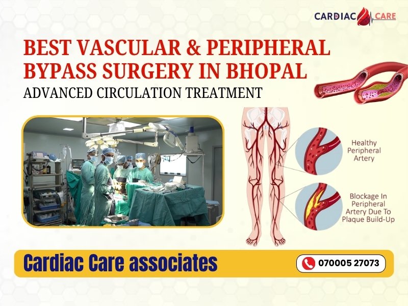 Advanced vascular and peripheral bypass surgery in Bhopal for restoring blood circulation in blocked leg arteries and improving limb health